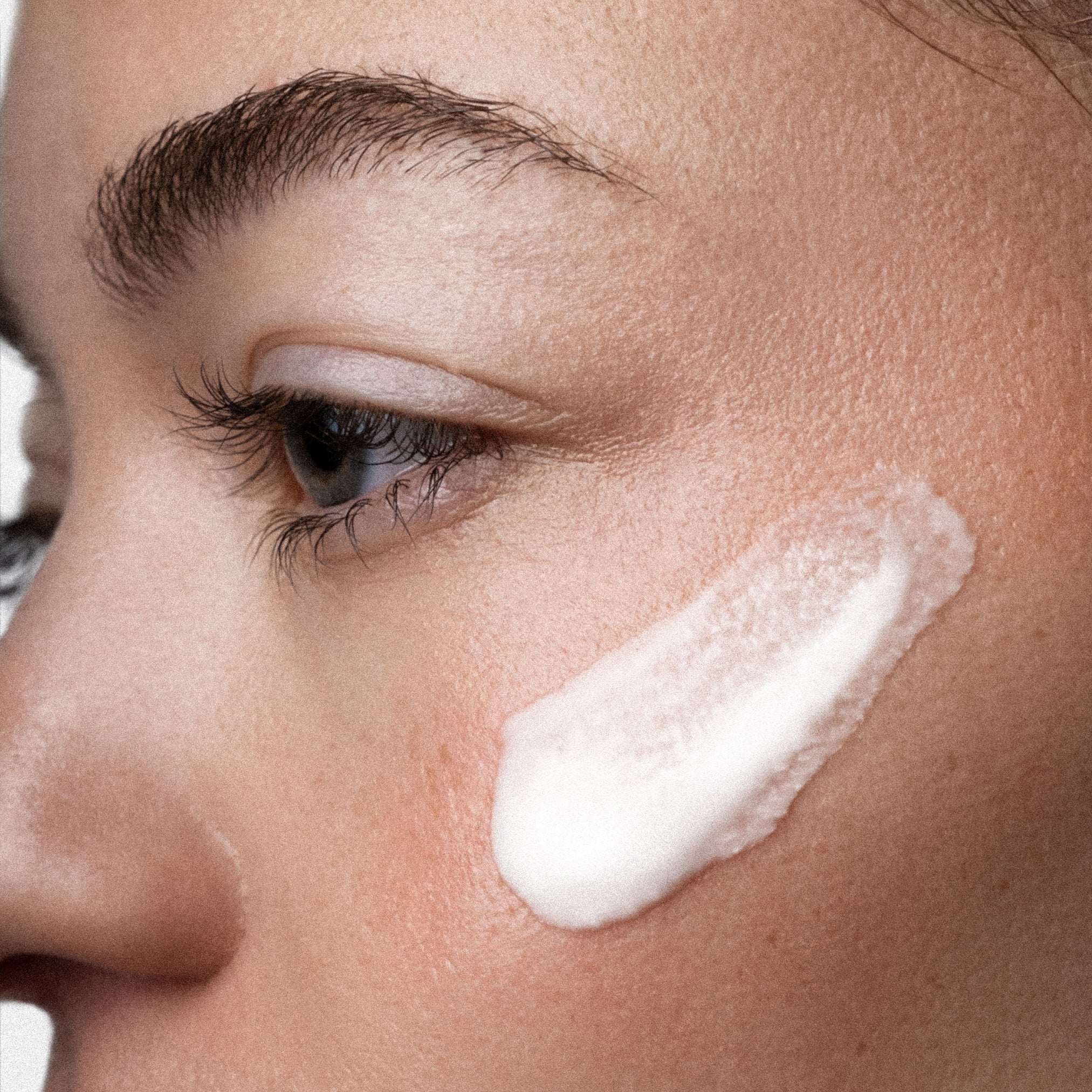 ÂN-DEW 10% Azelaic Acid + PHA Serum