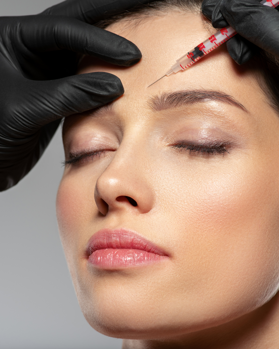 Wrinkle Relaxers: Botox & Xeomin Main image